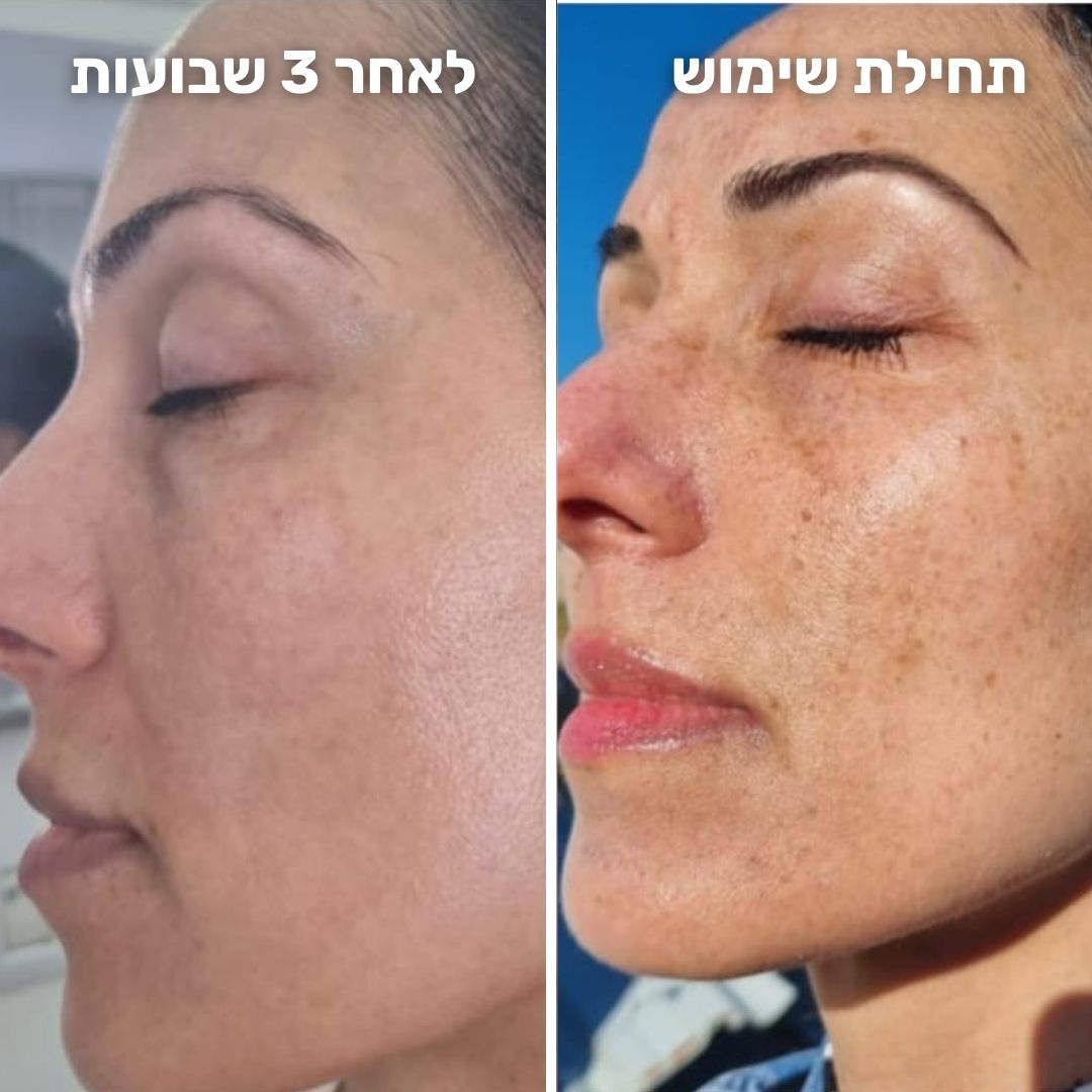 קרם לילה אקטיבי רטינול – תמונה 3