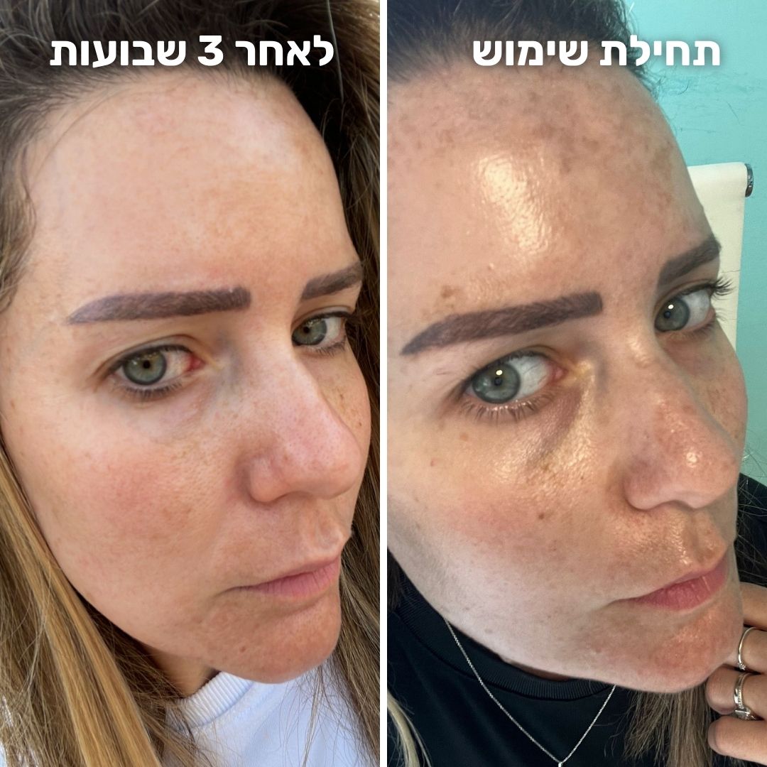 קרם לילה אקטיבי רטינול – תמונה 5